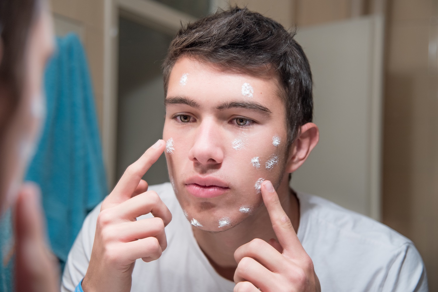 Facial pimples caused by shaving