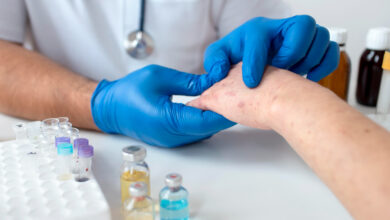 Почему лоб и нос становятся жирными: разбираемся в причинах