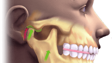 Лечение ВНЧС: есть ли способ избавиться от патологии