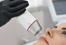 RF-лифтинг век: что это и как работает?