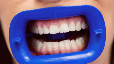 Лечение кариеса зубов: улыбка и лечение боли