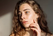 Акне: что это такое, причины и методы лечения